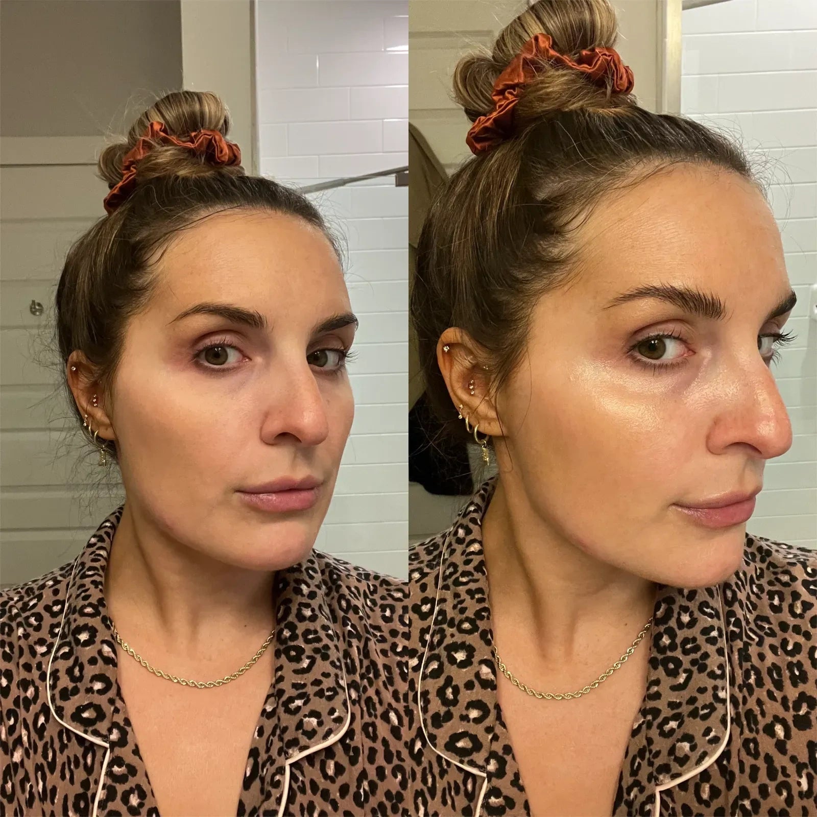 Before and after
